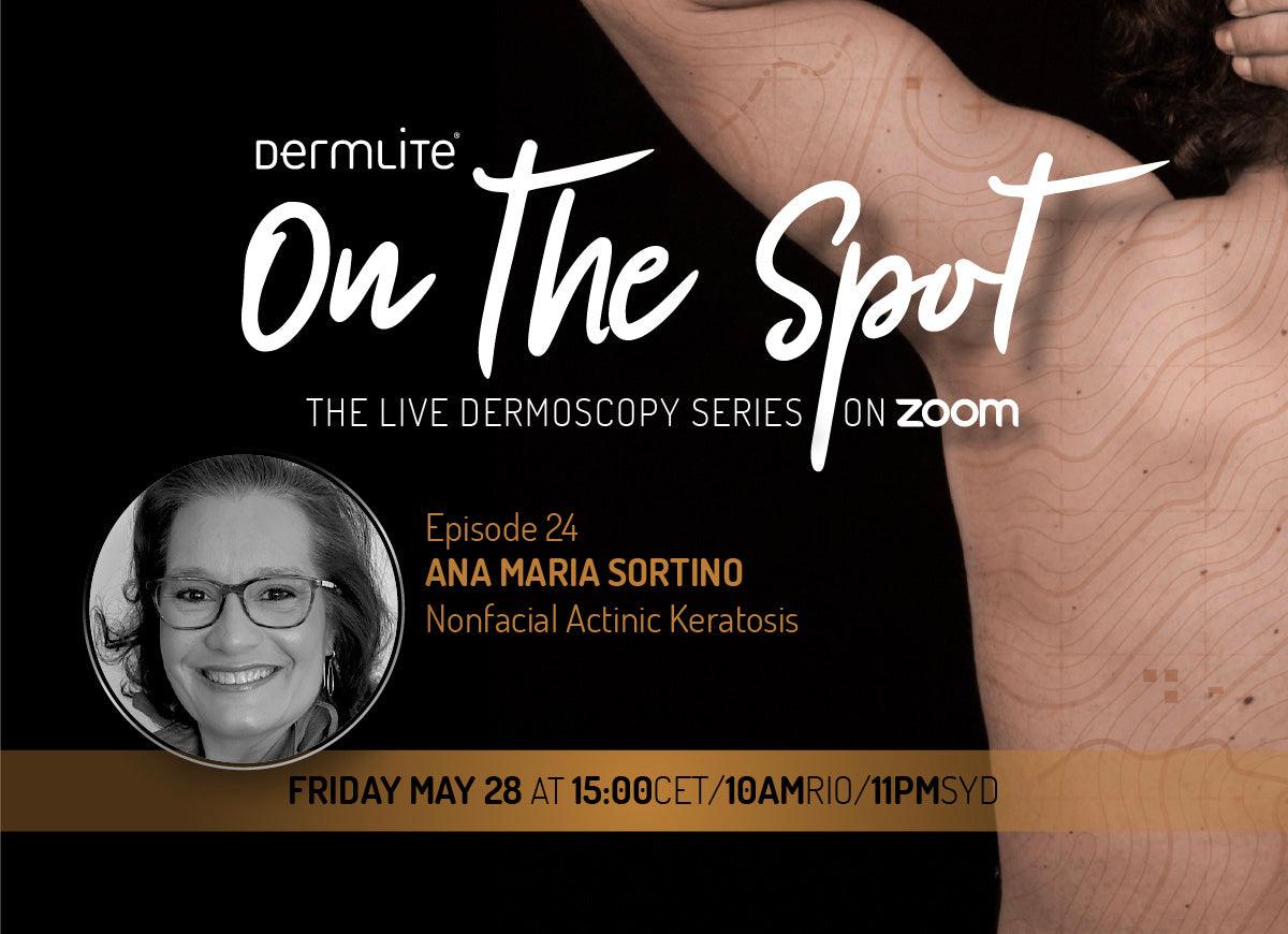 E24 | Nonfacial actinic keratosis - DermLite