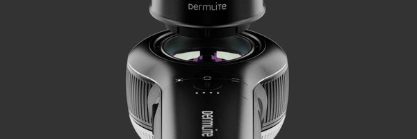 ダーモスコープ(DermLite Uva) ダームライト DermLite DL5 | Hybrid Dermatoscope | DermLite Online Store