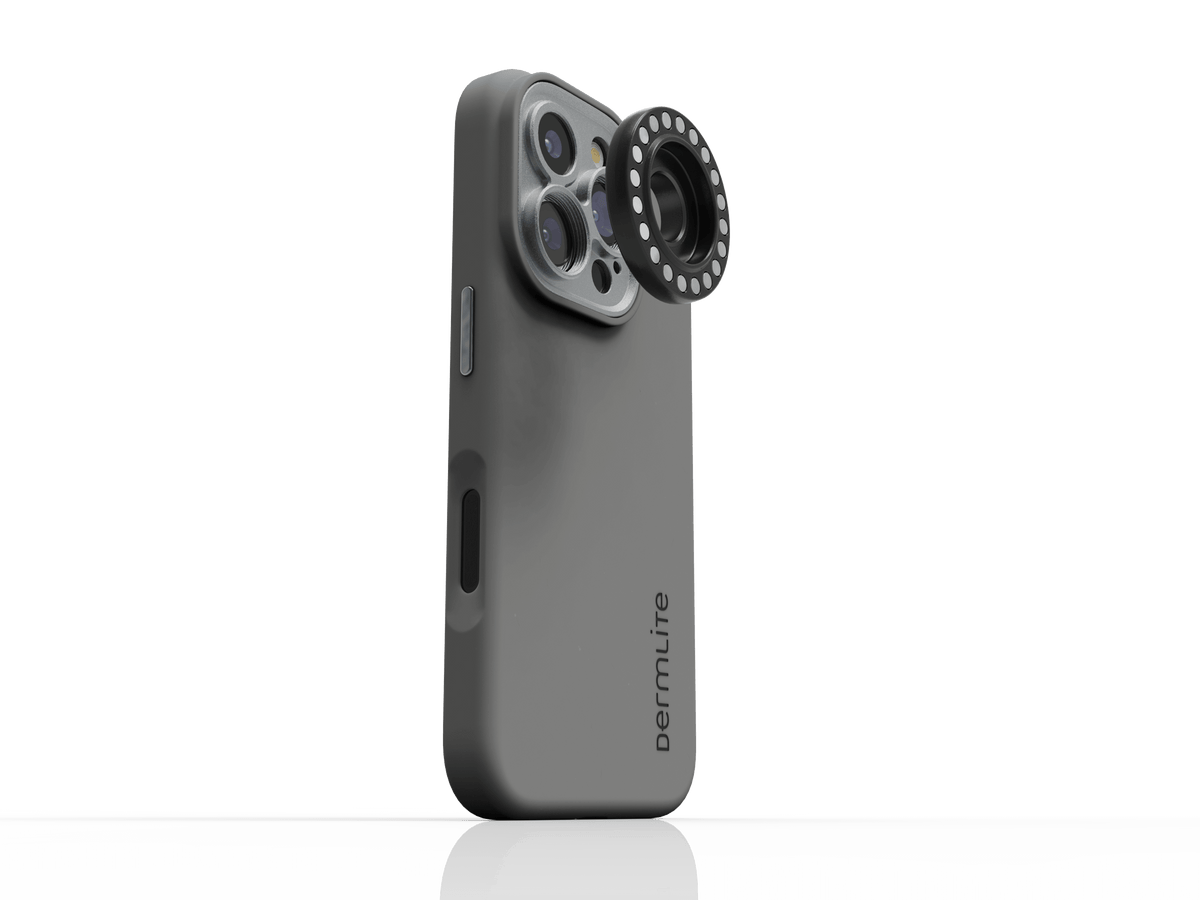 DL Connection Kit for iPhone 16 Series