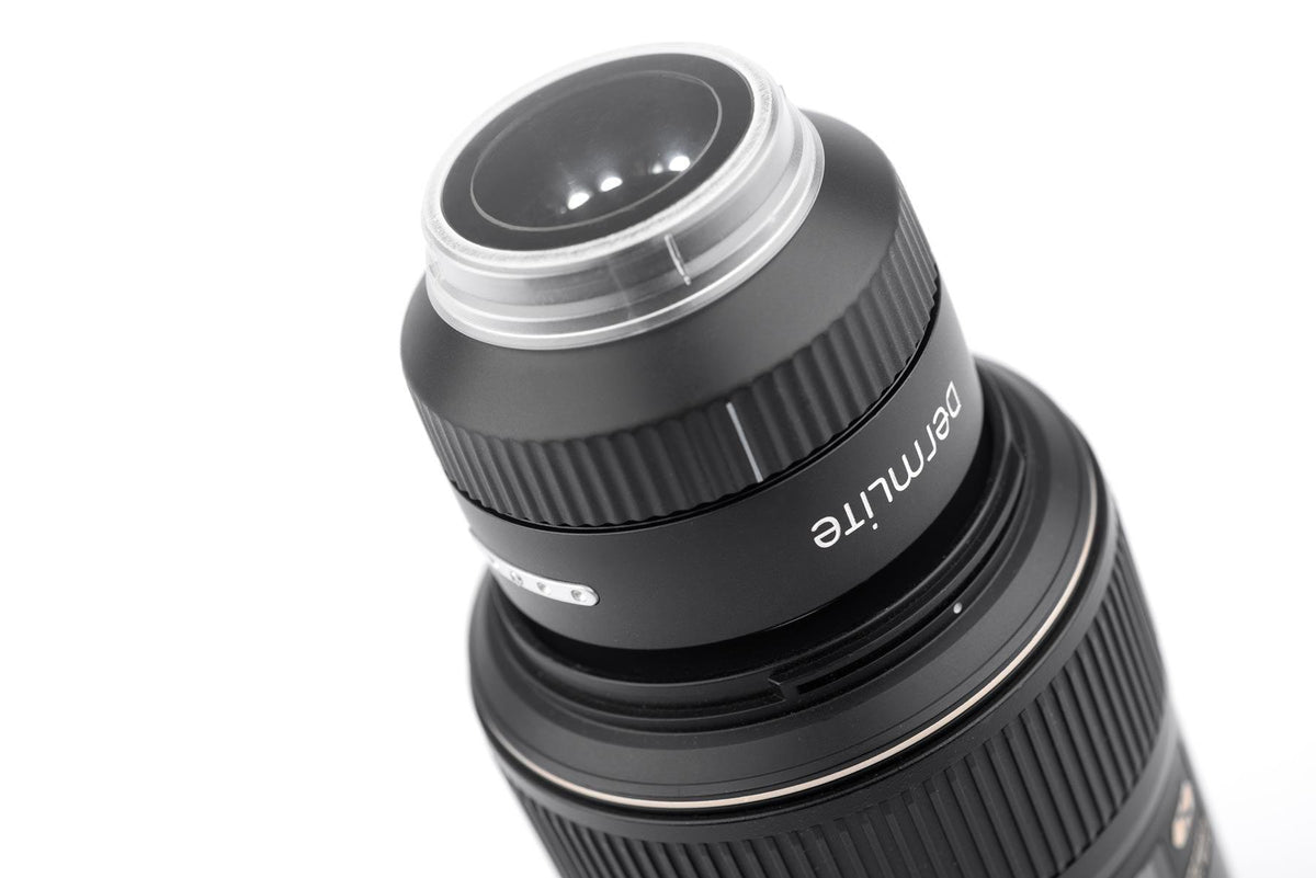 DermLite Foto X dermoscopy lens for SLR cameras