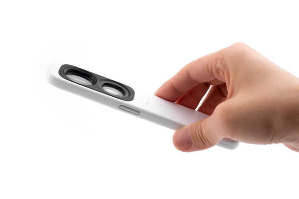 ダーモスコープ(DermLite Uva) ダームライト プロフェッショナルはこう使う！ダーモスコープ 「第1回