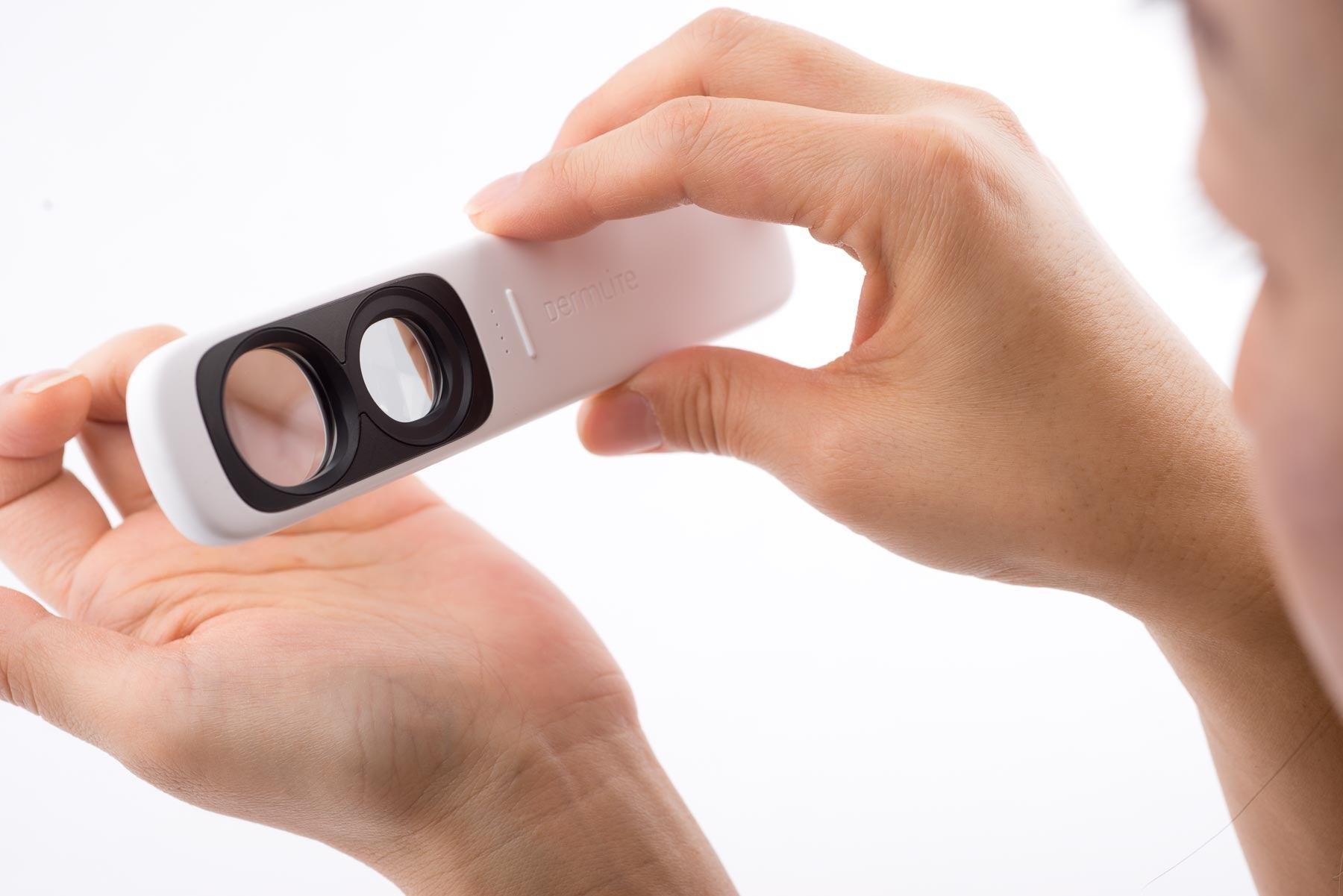 ダーモスコープ(DermLite Uva) ダームライト プロフェッショナルはこう使う！ダーモスコープ 「第1回