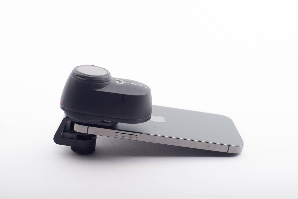 DermLite handyscope - DermLite