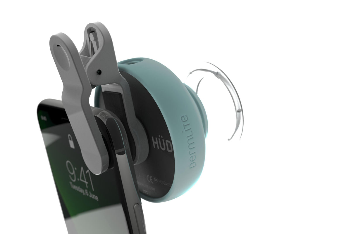 DermLite HÜD 2 Home Dermatoscope - DermLite